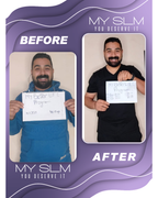 نتائج برنامج SLM لإدارة الوزن - صورة قبل وبعد لأحد المشتركين